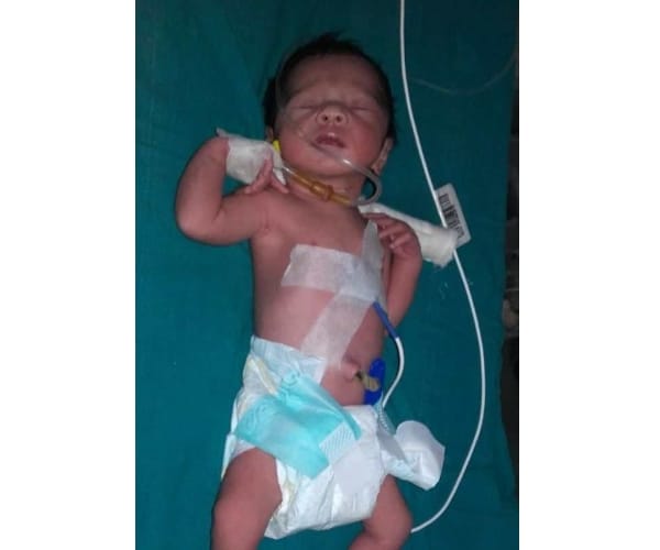 Negligence the delivery of maternal death.
