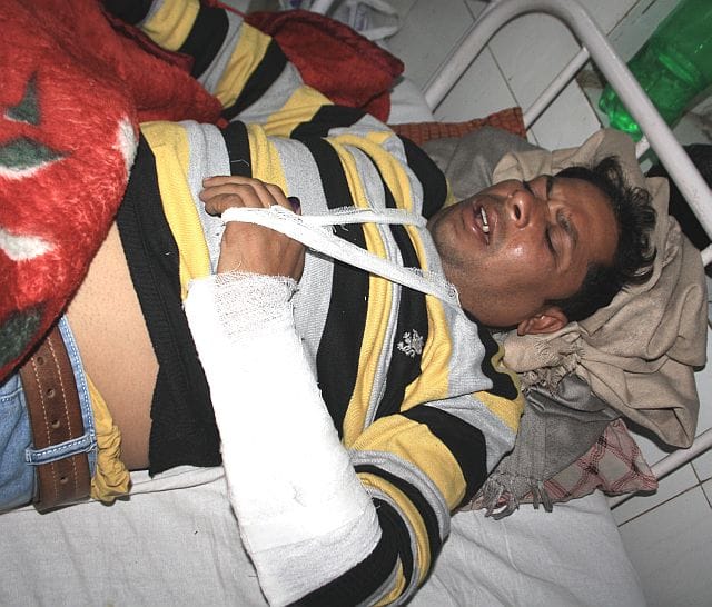 Parking was spat on, beaten man bouncers