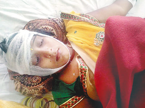 Woman injured in car collision minister's convoy