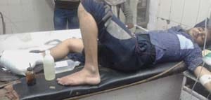 student injured in a bomb attack outside kpuc