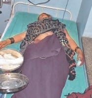 The milk used in tear acid attack on his own, jind news