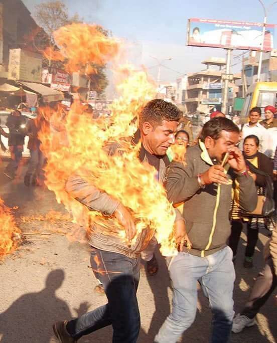 egs teacher try to burn himself at bathinda, admitted in hospital