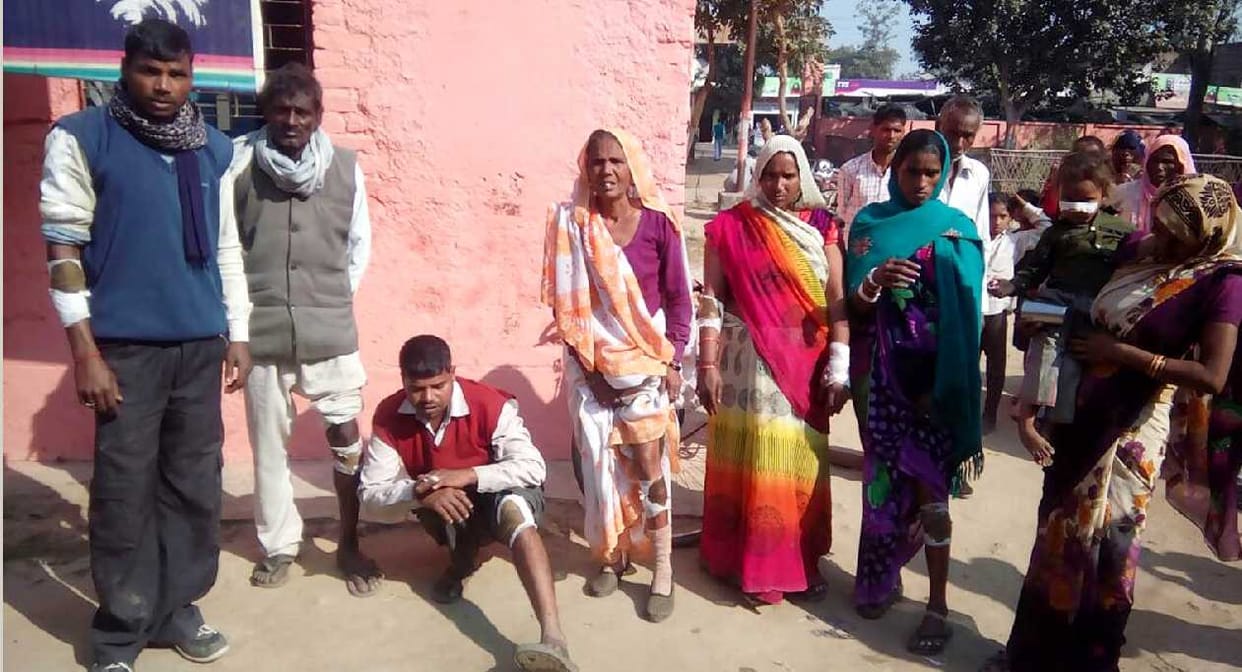 11 people bitten by wild animals