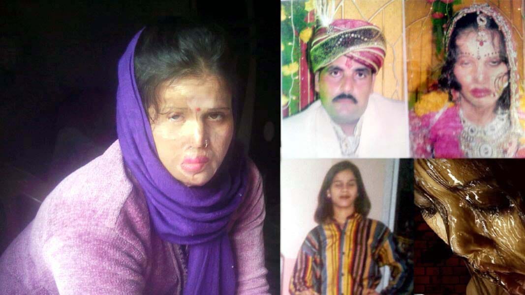 petition brought justice to pooja acid victims