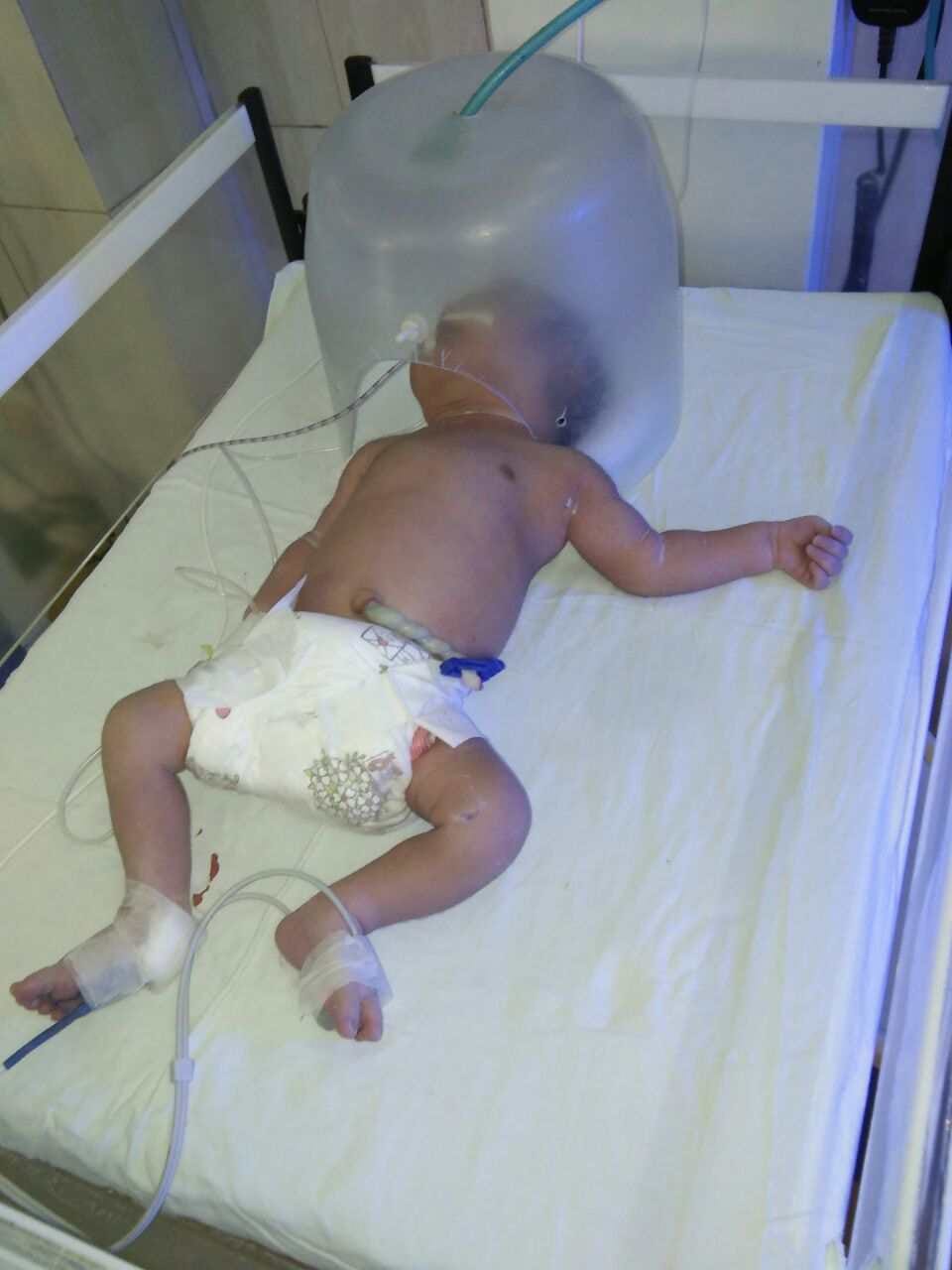 Newborn baby dumped in bushes