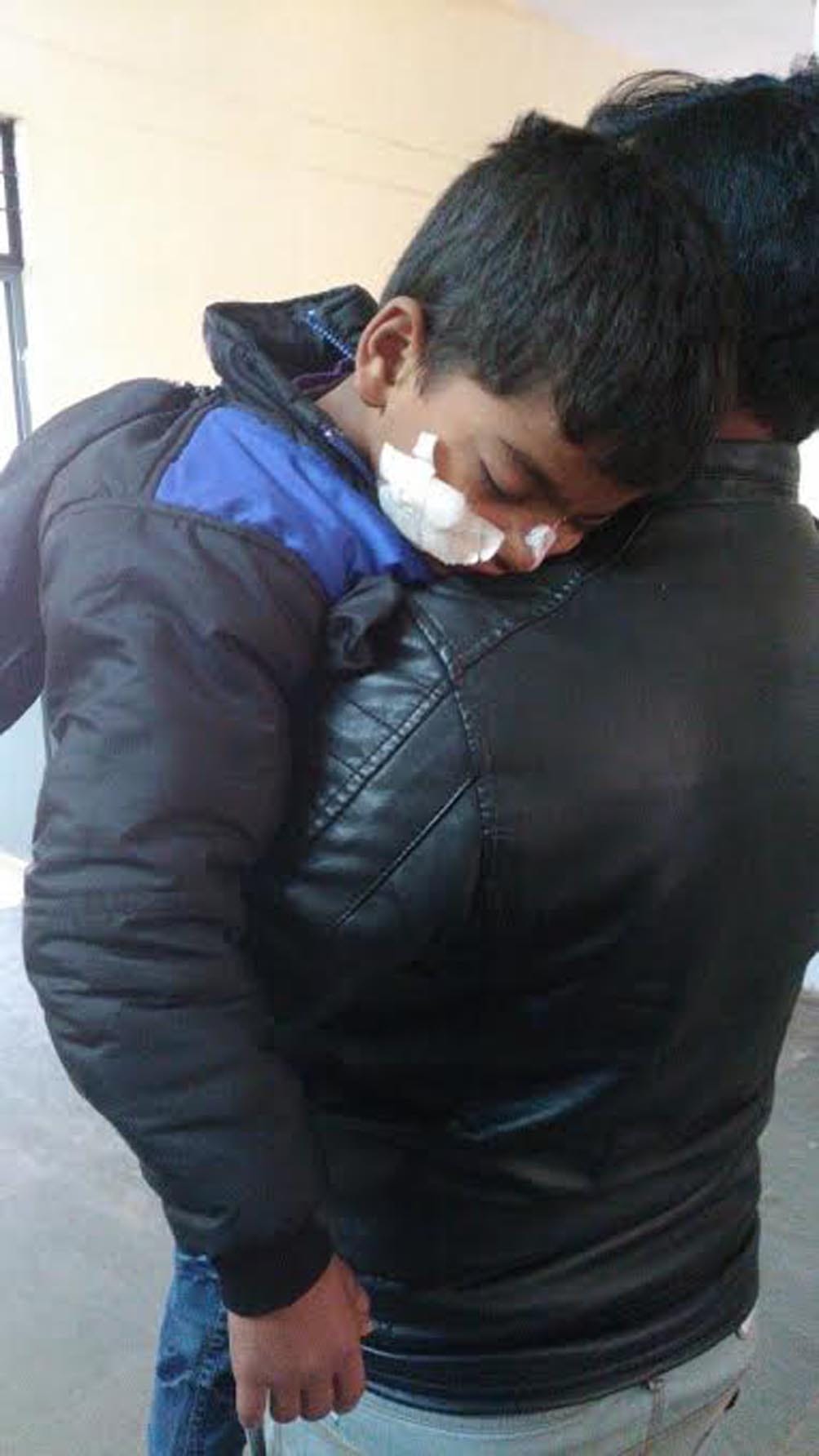 Threw acid on innocent Rnjisn