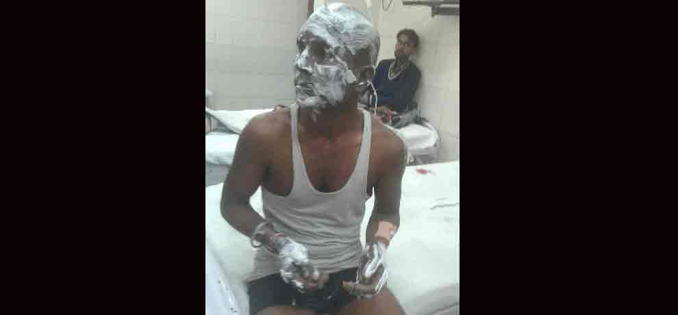 blast in illegal crackers in delhi two injured