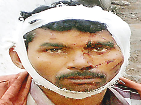 Uncle-nephew clashed six injured