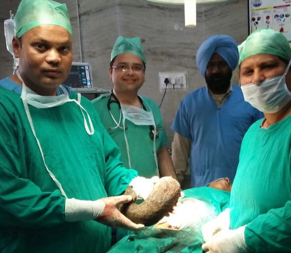 rare surgery of 15 years old girl surgery at ludhiana, bunch of hairs come out, doctors amazed