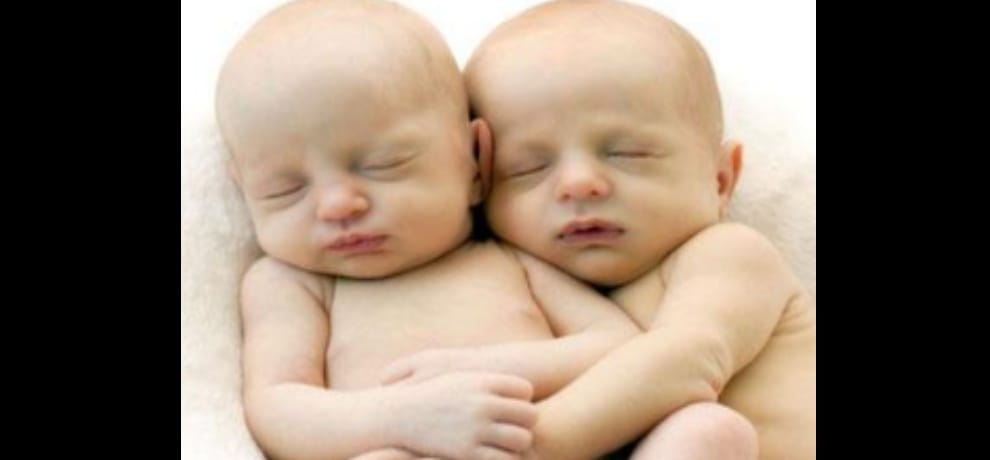 Twins birth, the hospital assigned a child, notice to hospital