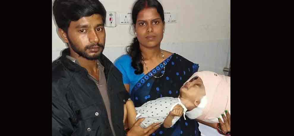 7 month old baby called ghost because he was having worlds largest head after disease 