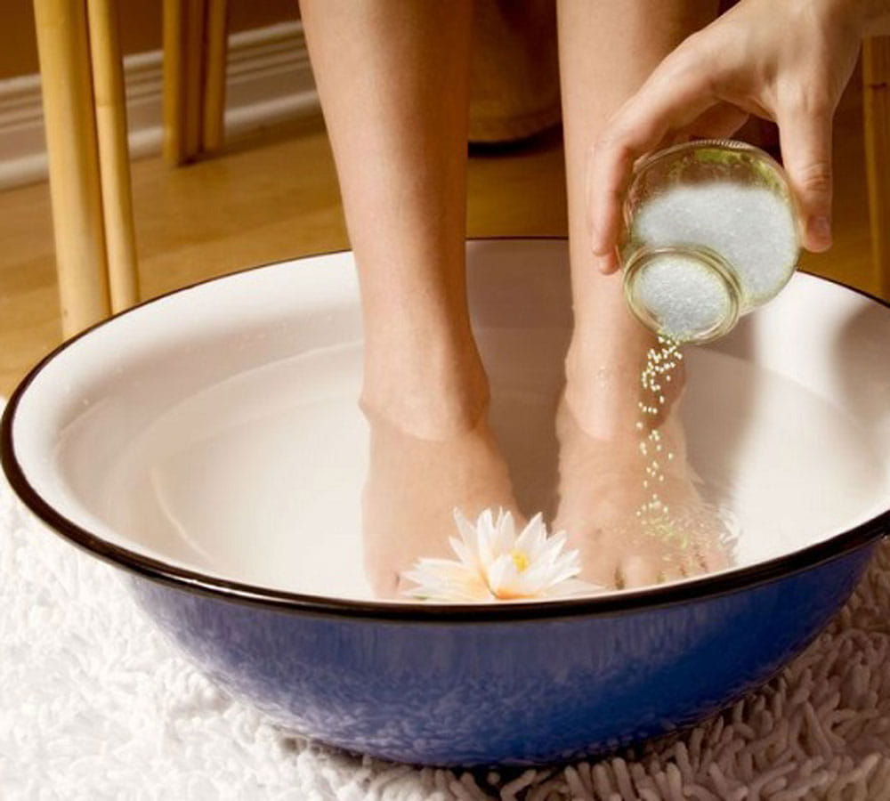 how to heel cracked heels