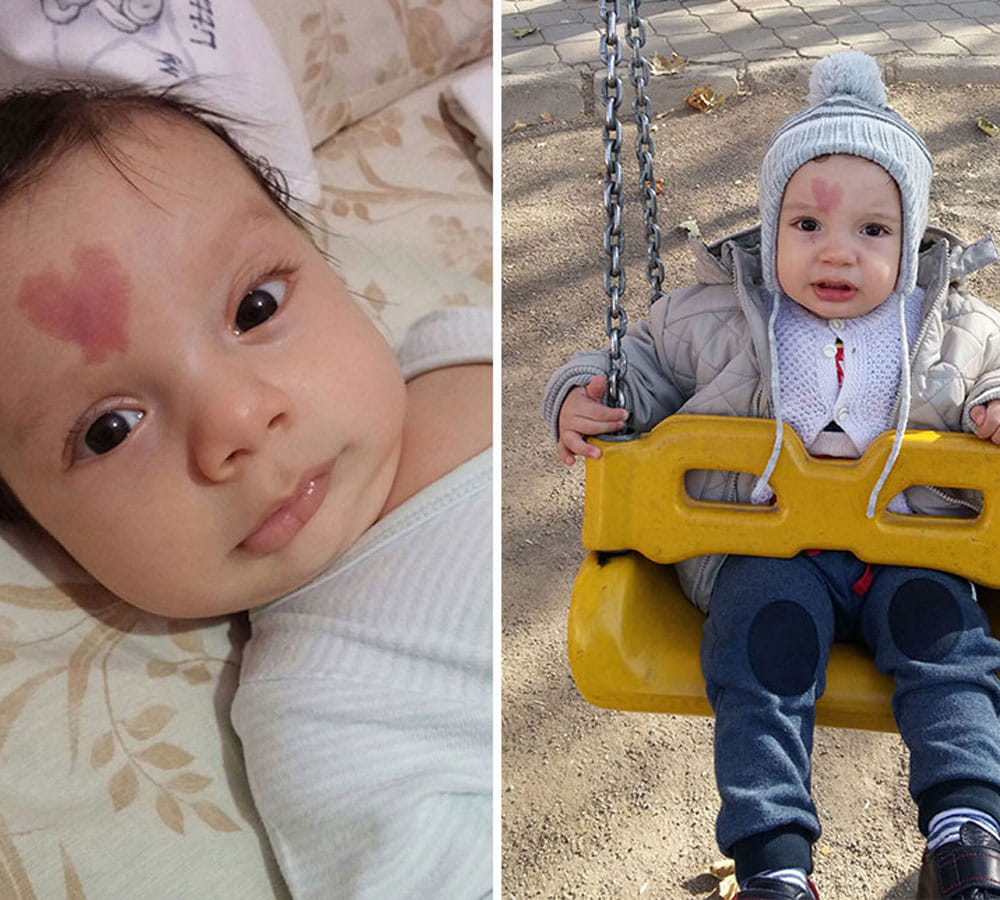 baby born with heart shape birth mark