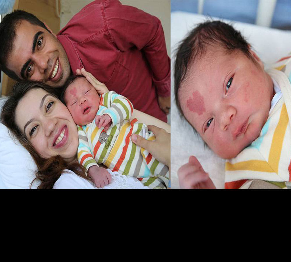 baby born with heart shape birth mark