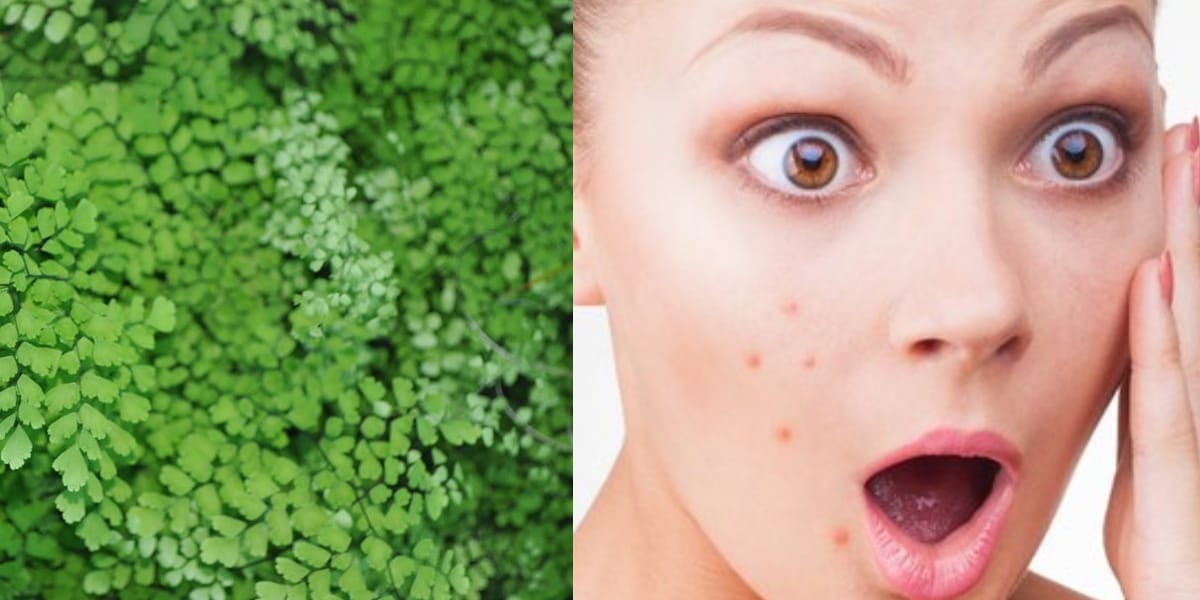 Adiantum capillus veneris help fight skin infections like acnes and fungal infection