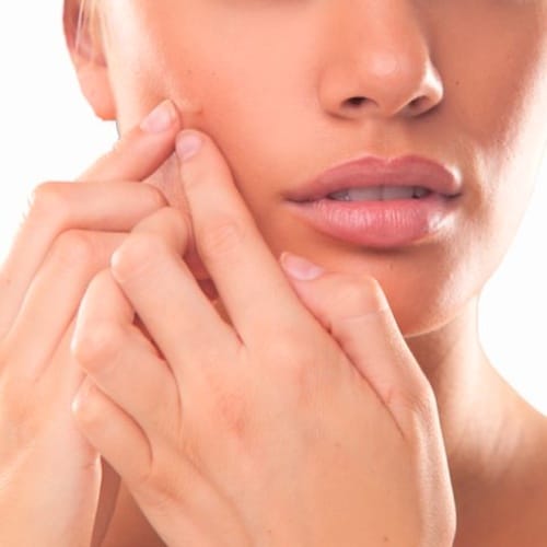Skin problems during pregnancy and their solutions