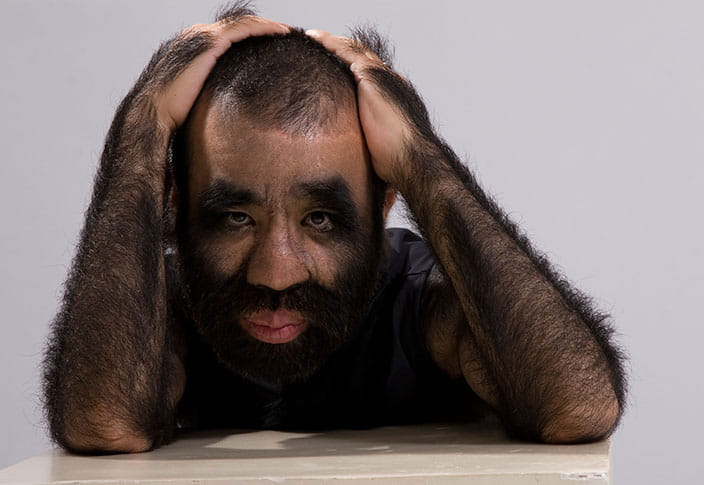 Meet the hairiest man on Earth