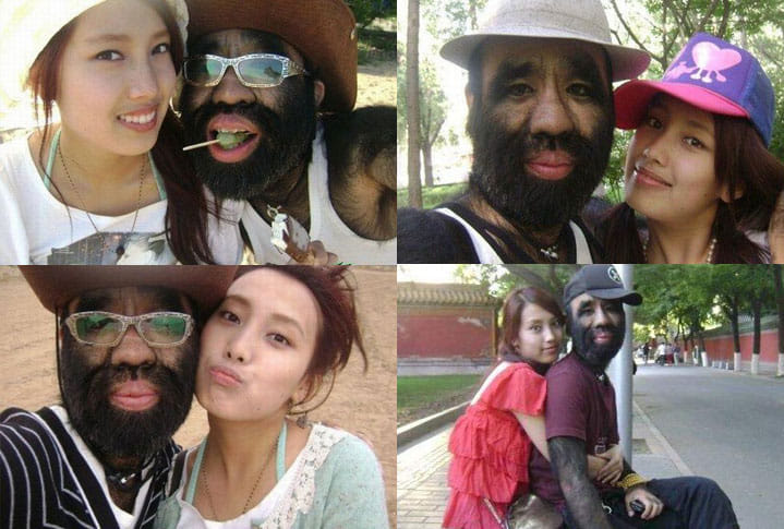Meet the hairiest man on Earth