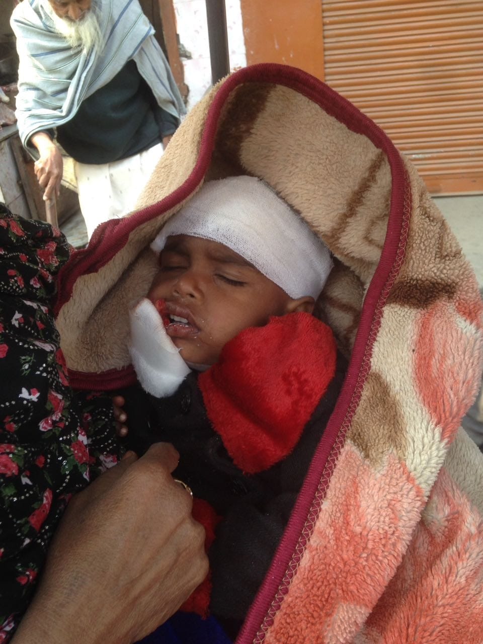 Stray dogs in city's panic, two-year-old child put severely to scrape