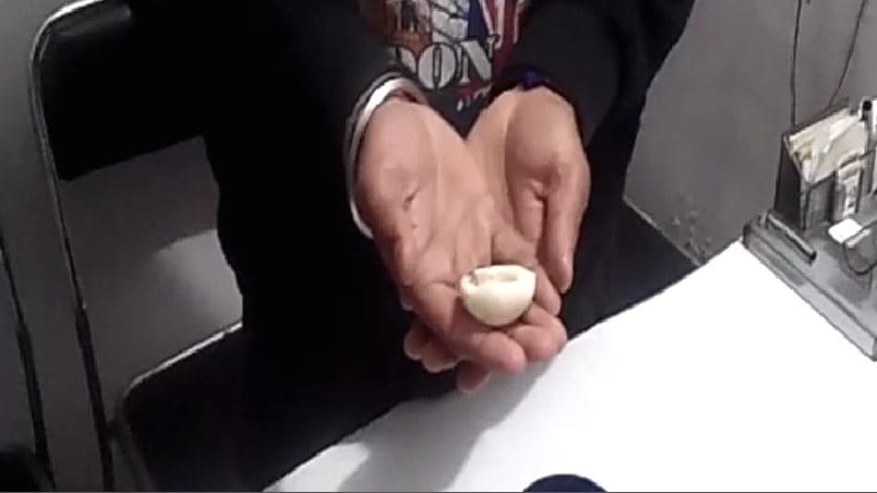 Poisonous worm found in Egg.