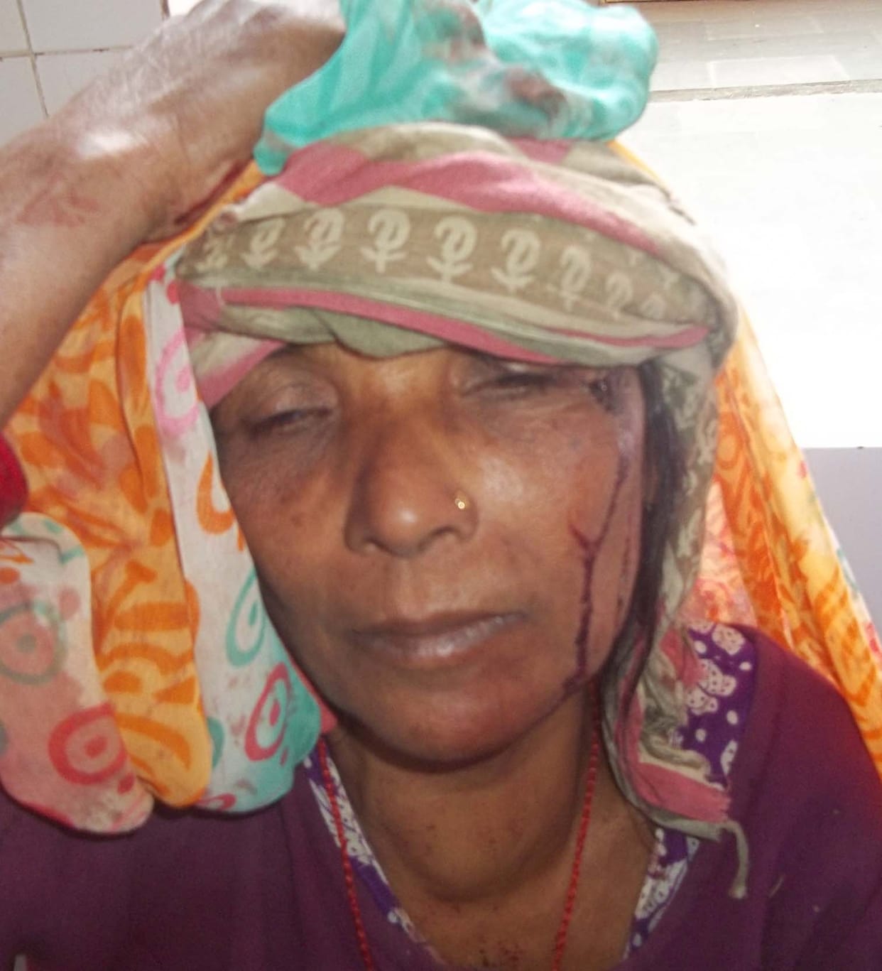 The two sides went into sharp Weapons, 10 injured