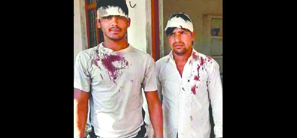 Phirni attacked on the metering, four injured