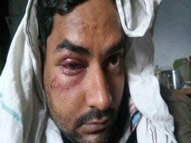 Police constable wounded the eye of young man