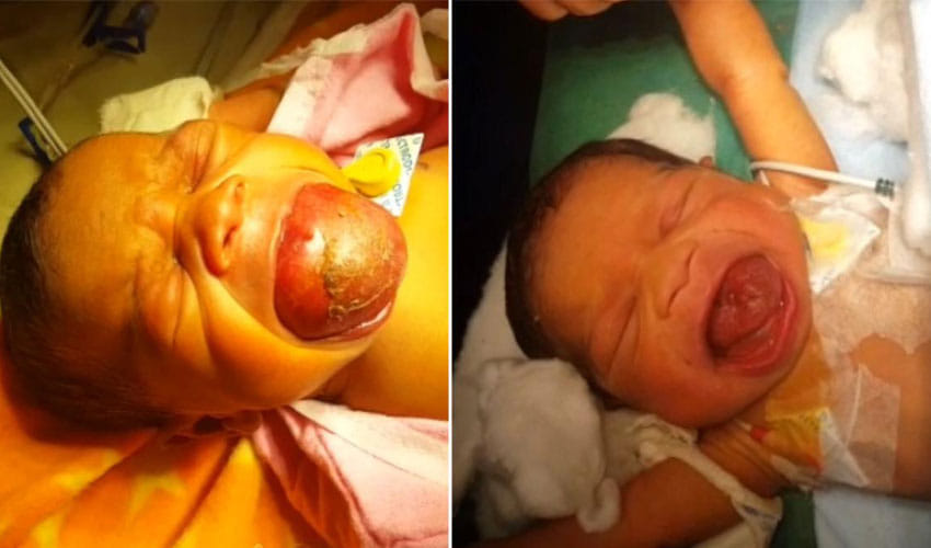 an infant with a giant tongue