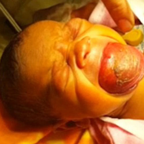 an infant with a giant tongue