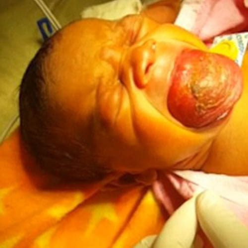 an infant with a giant tongue