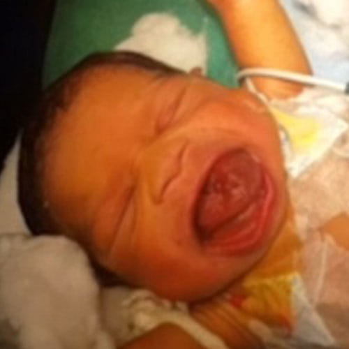 an infant with a giant tongue