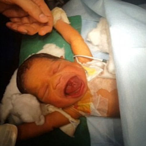 an infant with a giant tongue