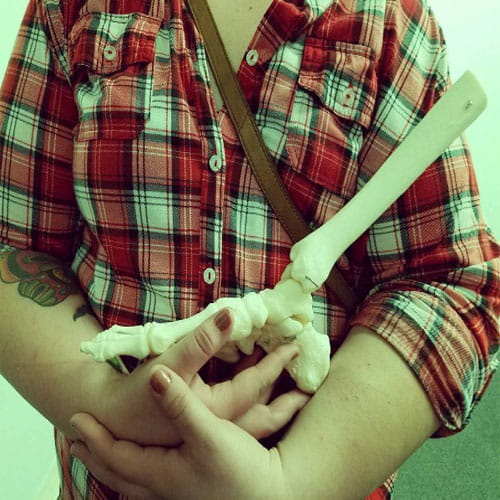 Girl In America Kept Her Leg After Doctor Cut It Off From Her Body