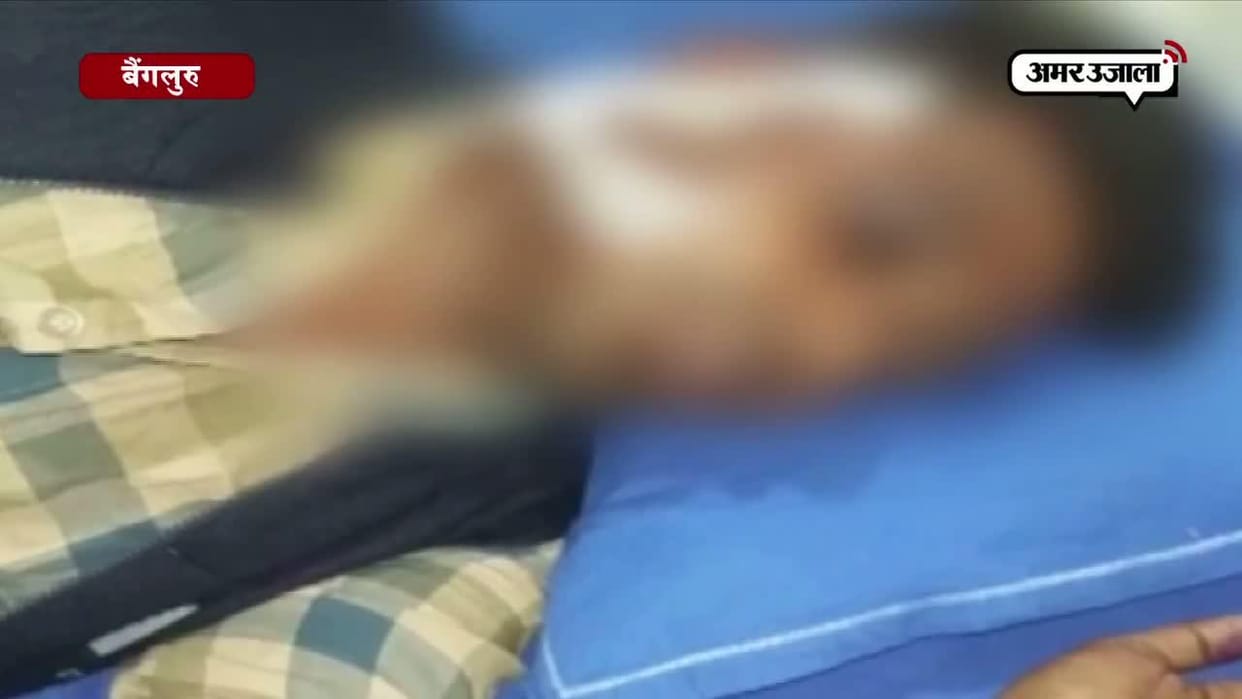Bike riders thrown acid at young man