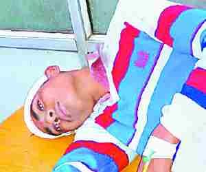 Student hit by a bat during match