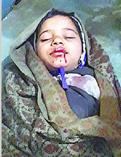 Seven injured in attack