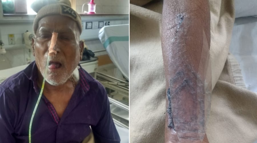 doctors gave new life to cancer patient in lohia sansthan