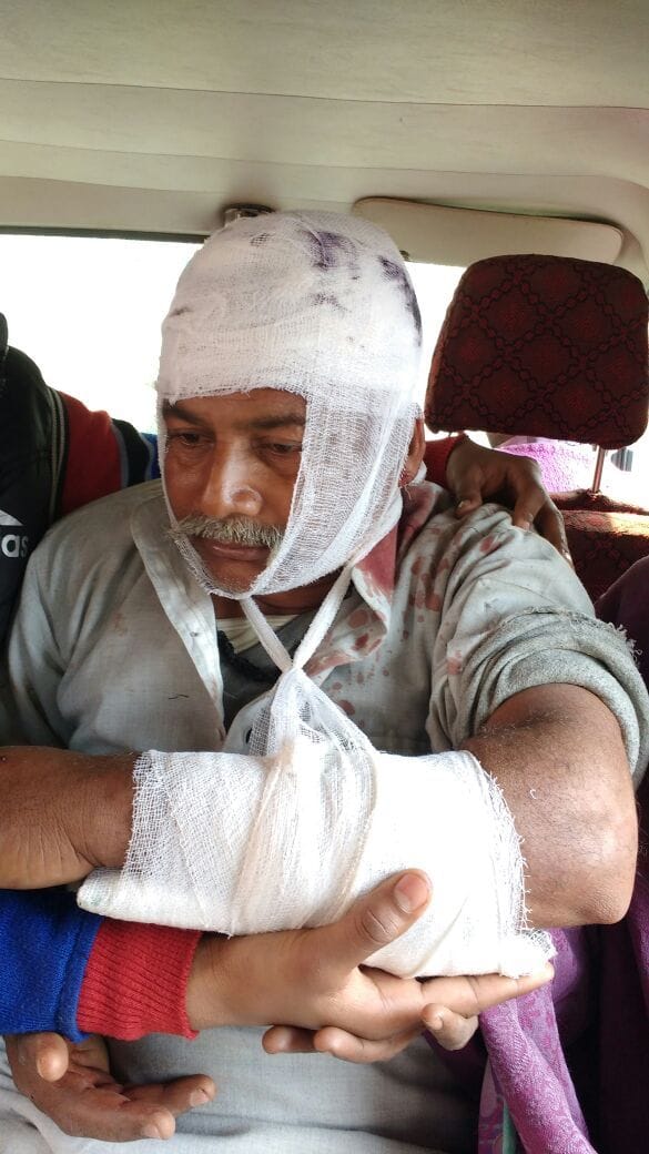 beaten to elder brother in front of police