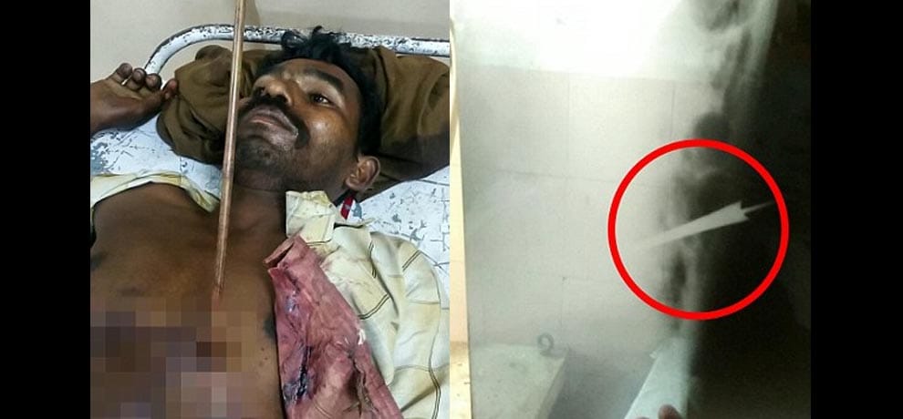 man brutality injured by his elder brother in Madhaya Pradesh 