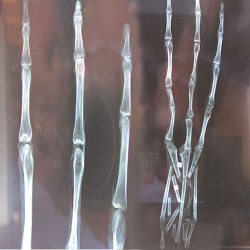 Scientists Claim Bones Found In Peru Are Of Aliens
