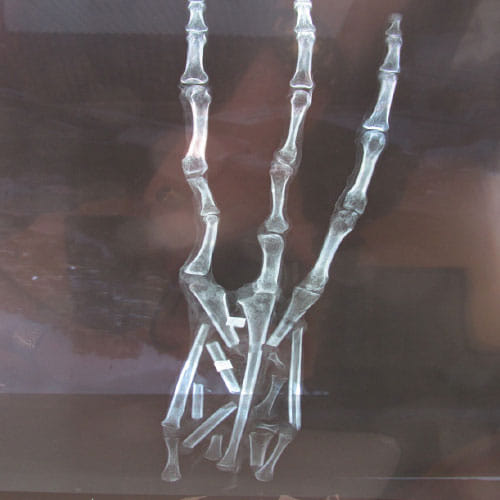 Scientists Claim Bones Found In Peru Are Of Aliens
