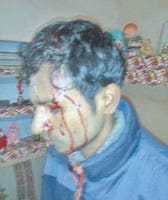 The family flag flying attack, three wounded, Ambala