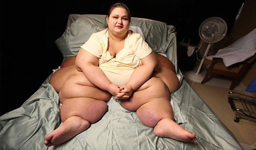 this lady sheds 450 kilos and become slim trim
