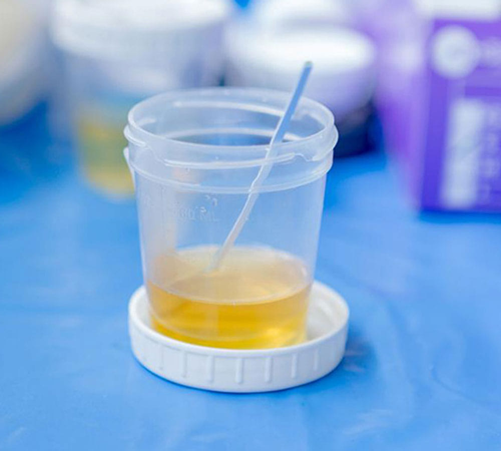use vinegar for pregnancy test