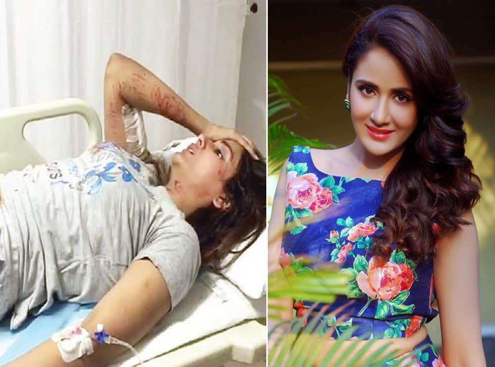 South actress attacked by stray dogs