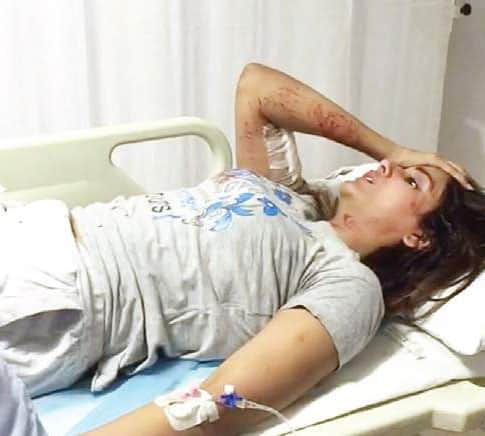 South actress attacked by stray dogs