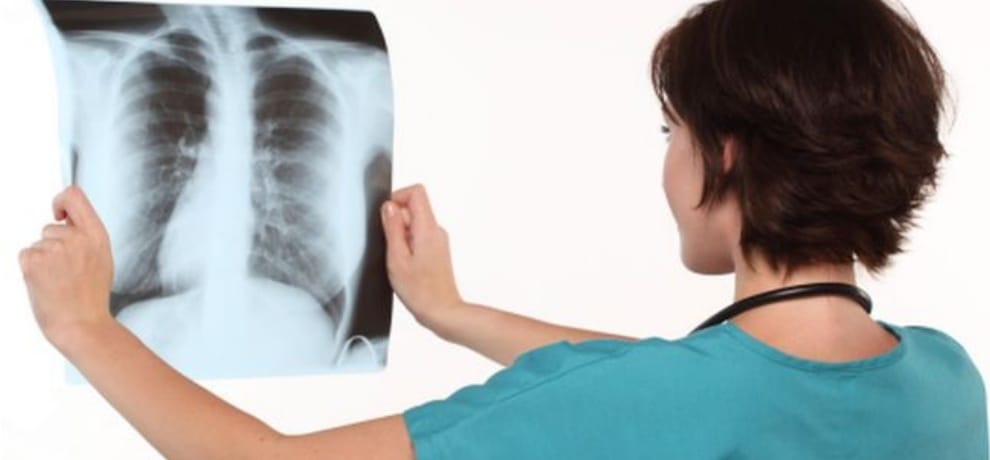 iit mandi scientists research for tuberculosis testing kit
