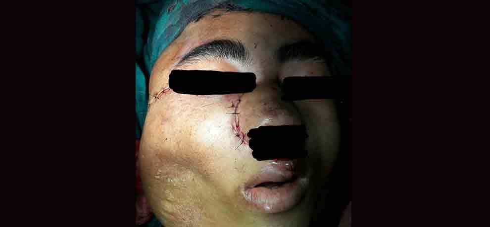 six people in the world are suffering from this disease, 17 year old boy from india is sixth patient
