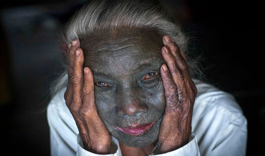 Husbands Make Their Wives Unattractive In this country