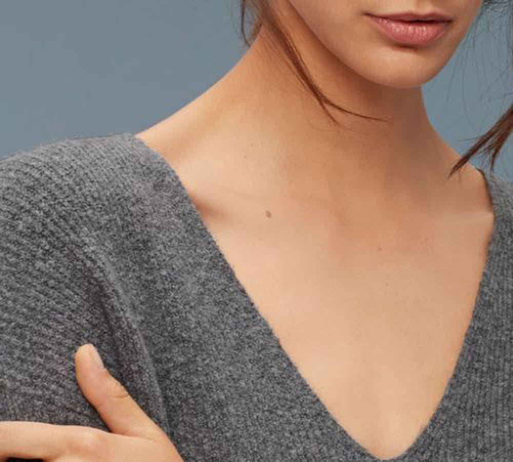rashes in winters because of woolen clothes